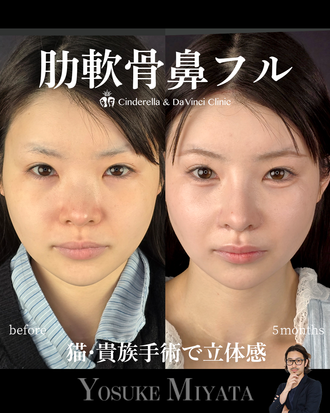 忘れ鼻をつくるの画像