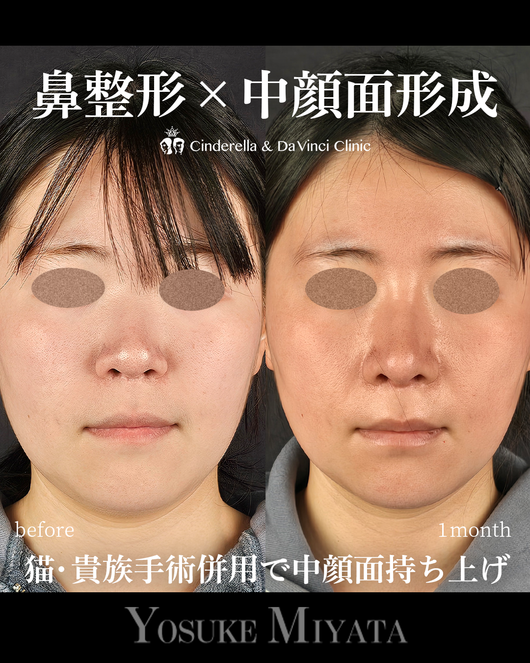 猫手術と貴族手術の画像