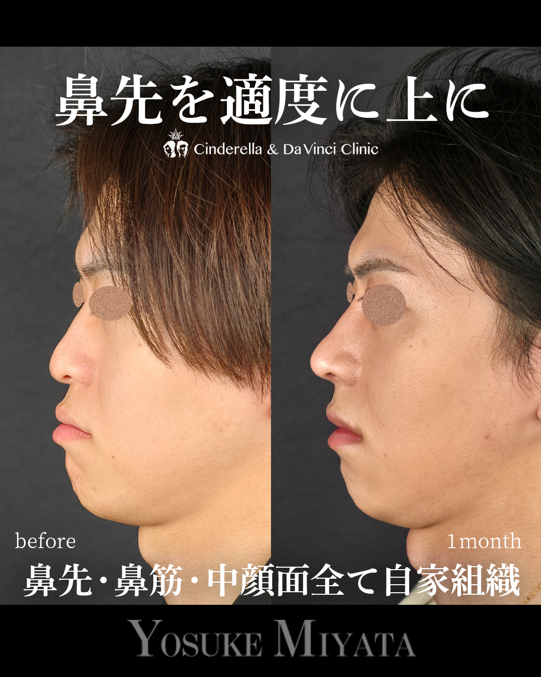 鼻先の角度を上に