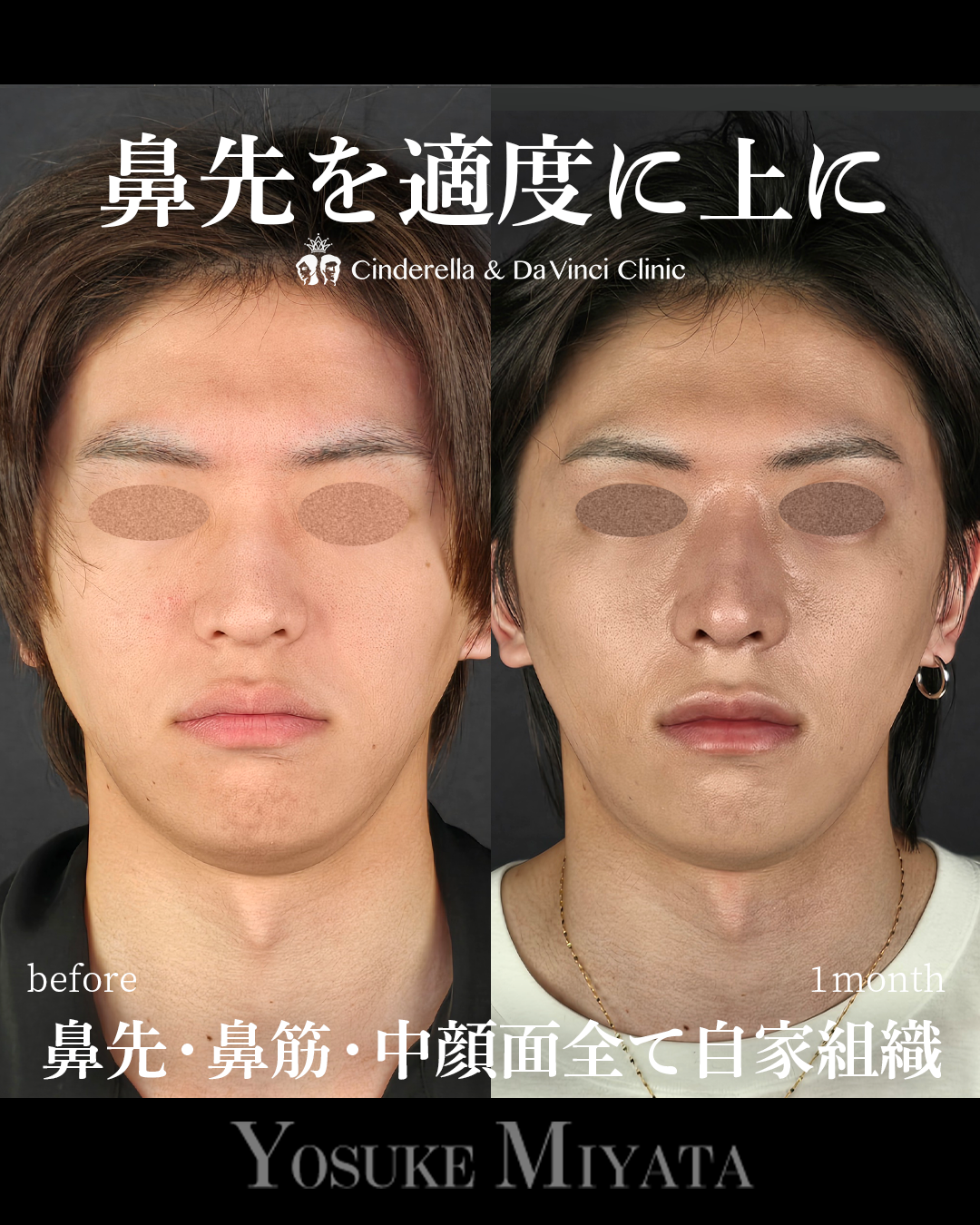 鼻先の角度を上にの画像