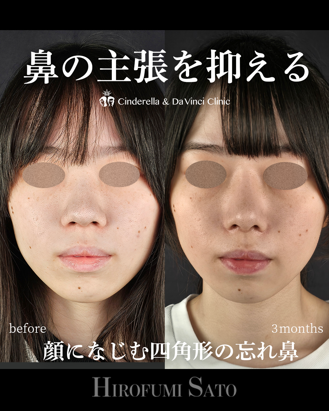 鼻の主張を抑えるの画像