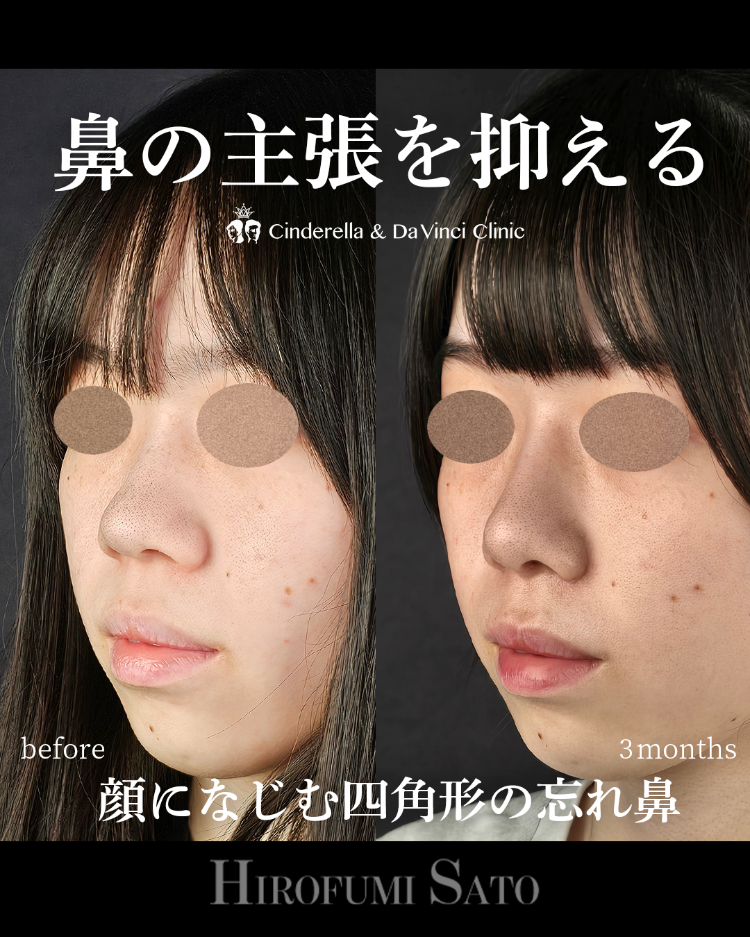 鼻の主張を抑えるの画像