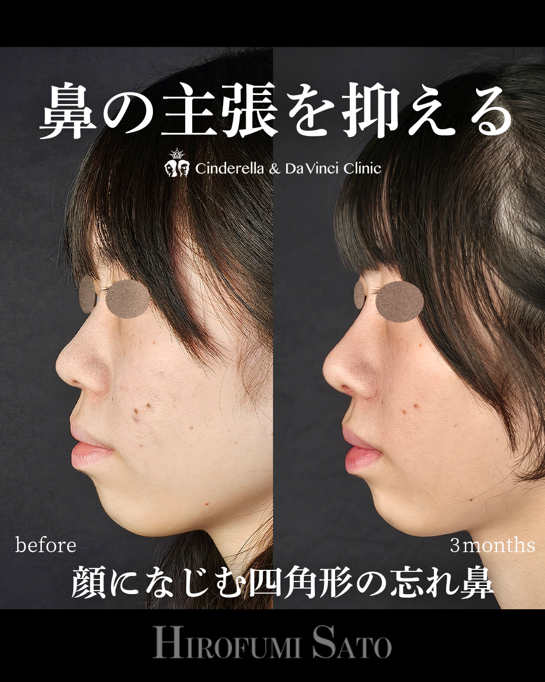 鼻の主張を抑えるの画像