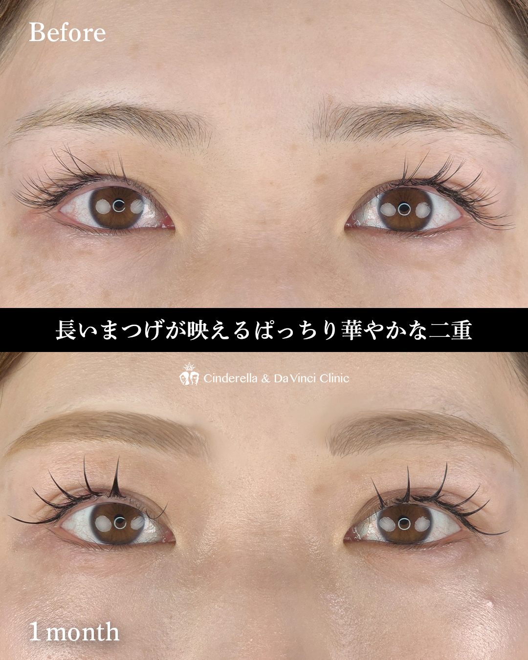 まつげがきれいに見える二重の画像