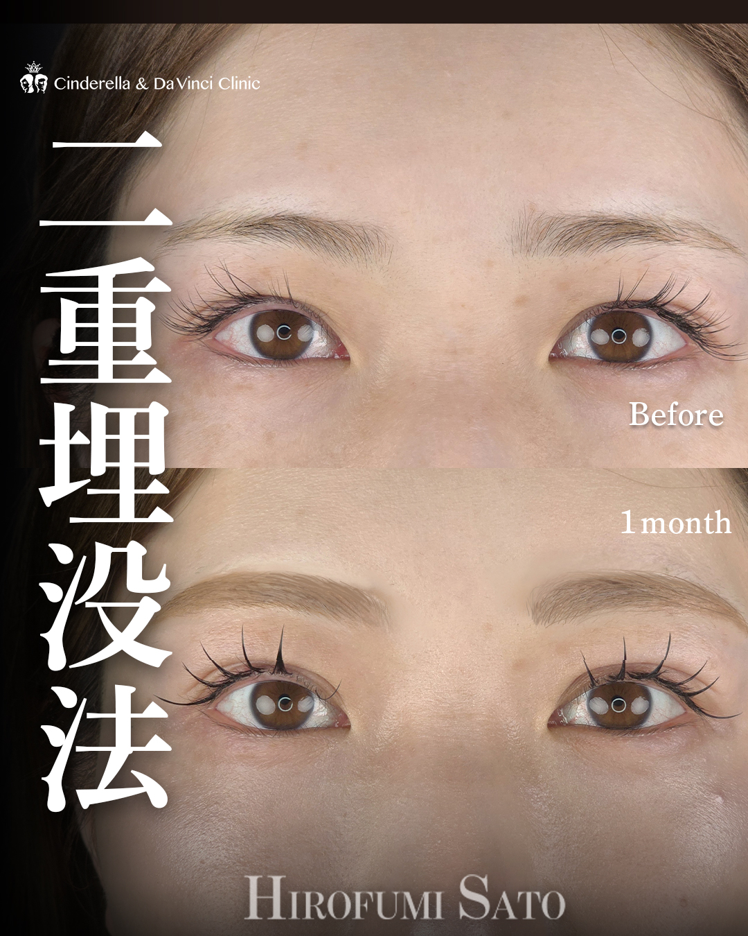 まつげがきれいに見える二重