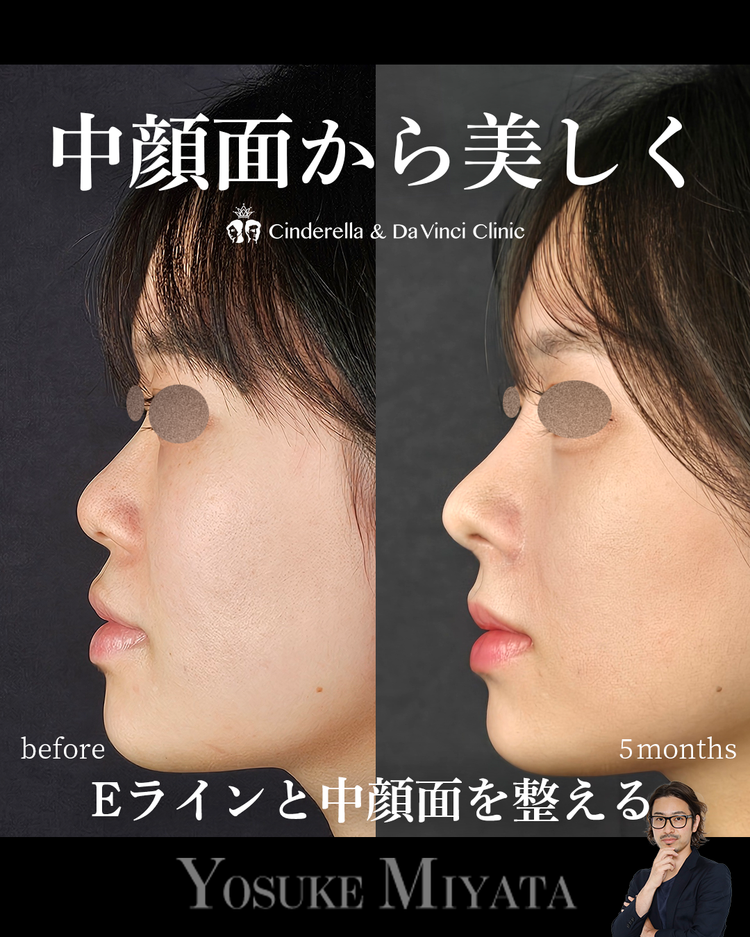 すべて自家組織の画像