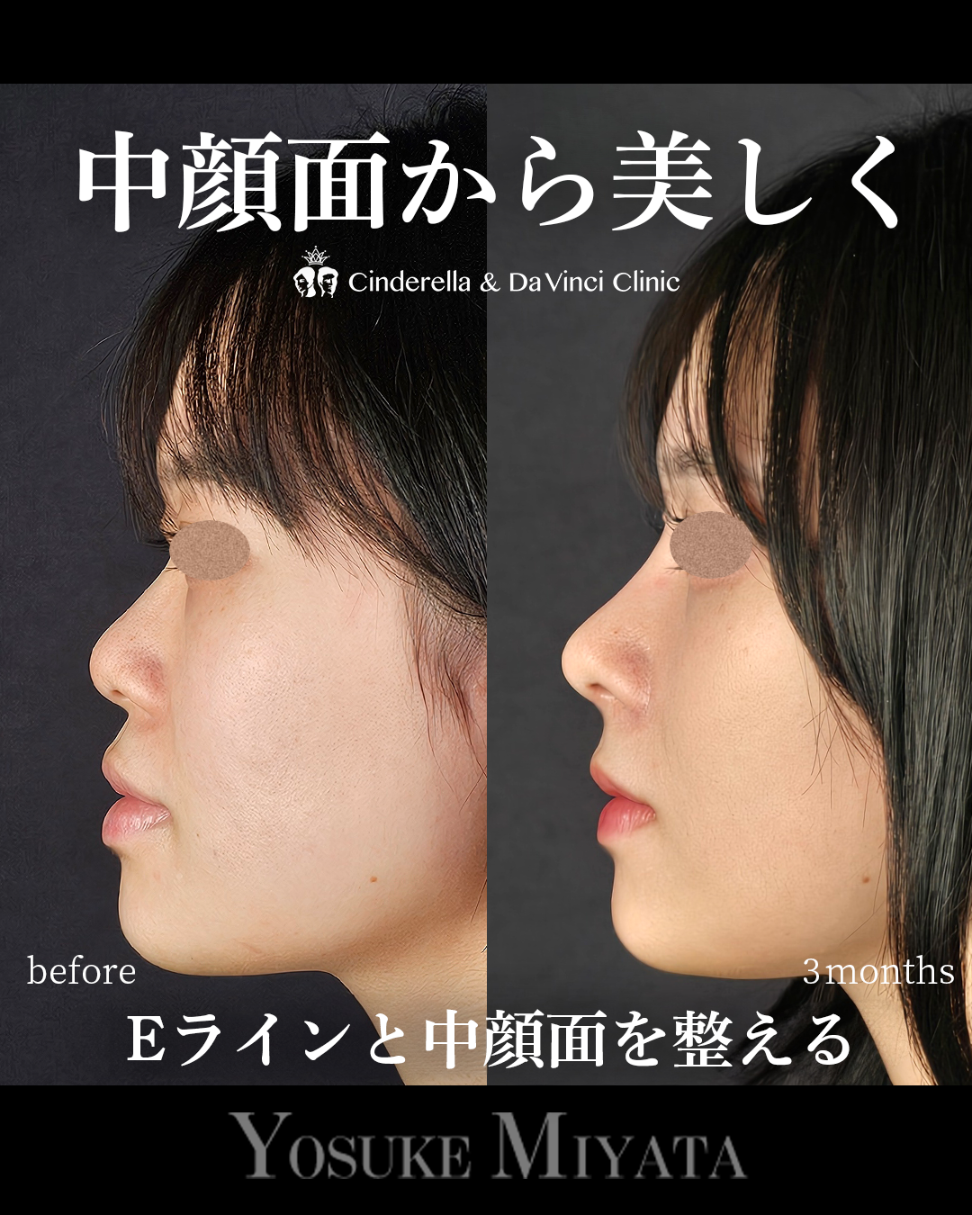 すべて自家組織の画像