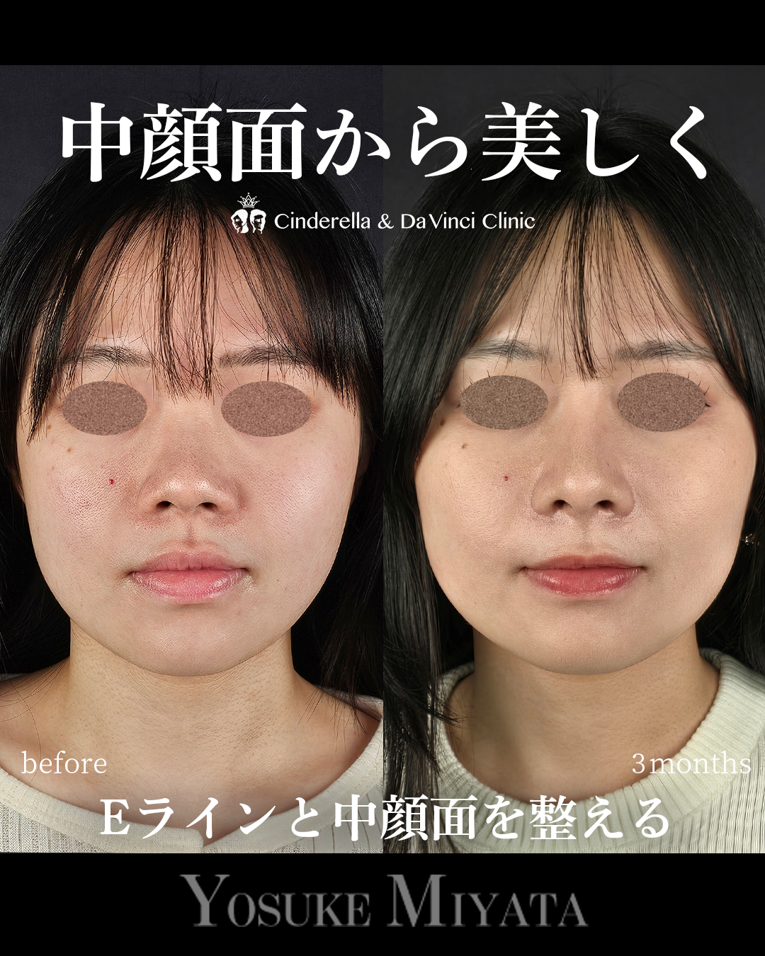 すべて自家組織の画像