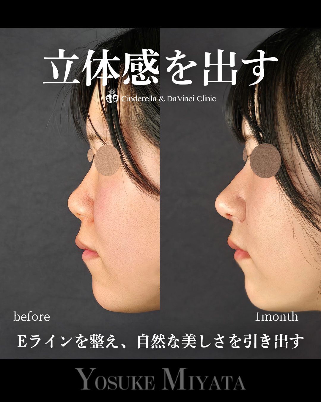 お顔に立体感を出す