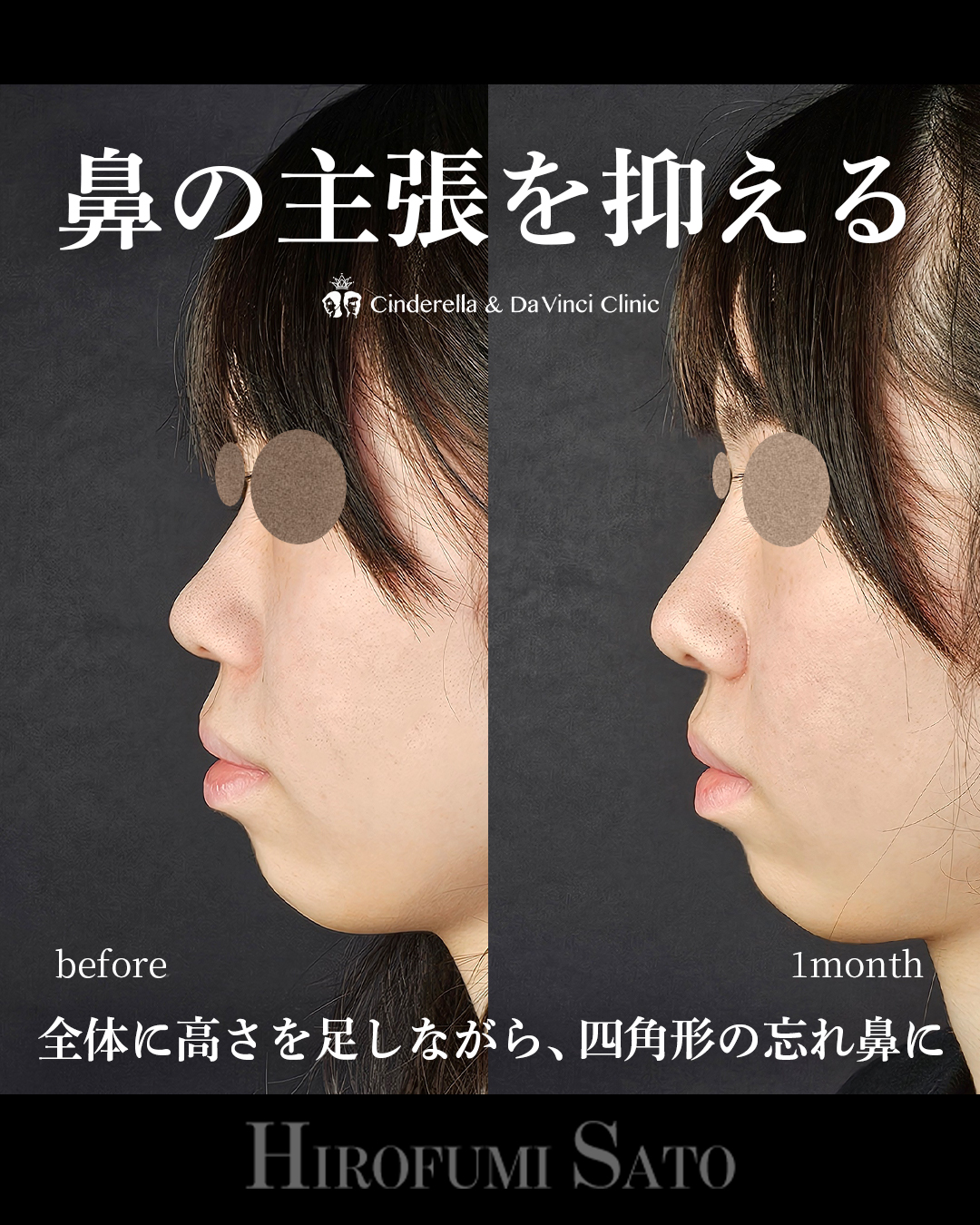 鼻の主張を抑える