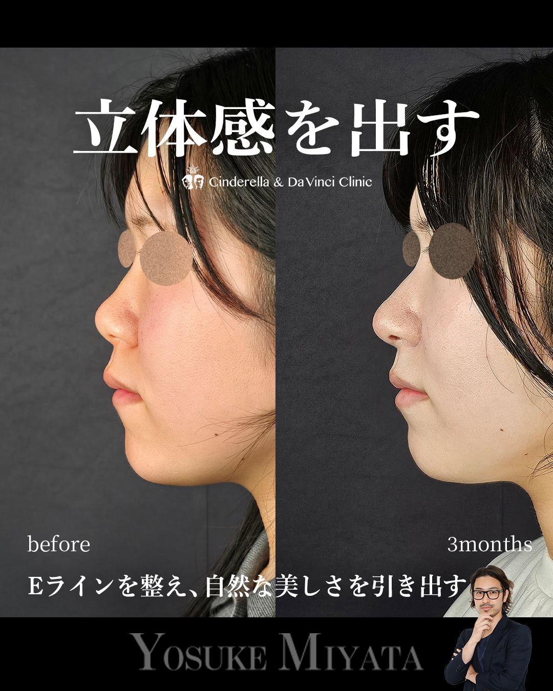 お顔に立体感を出すの画像