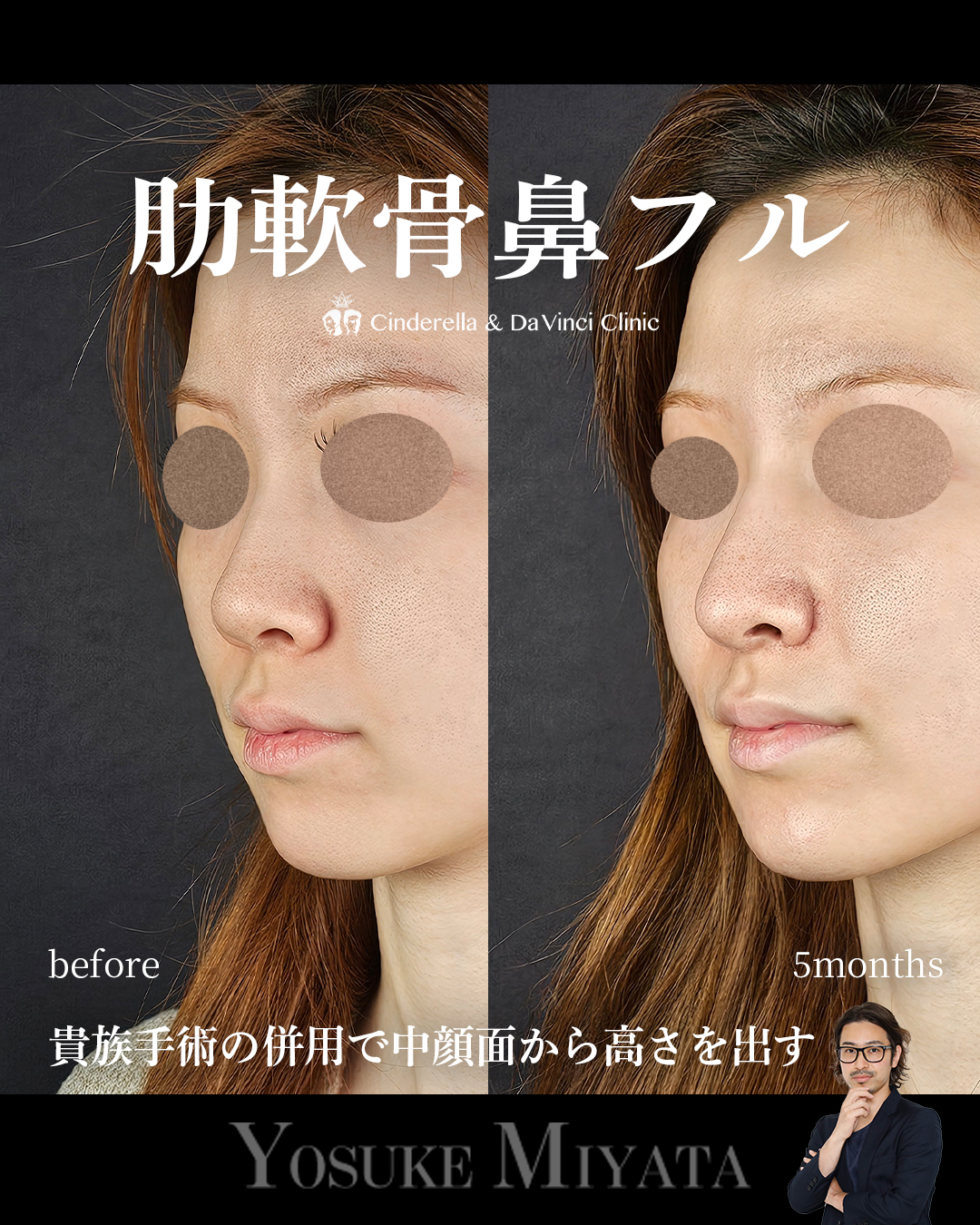 バランスの良い鼻の画像