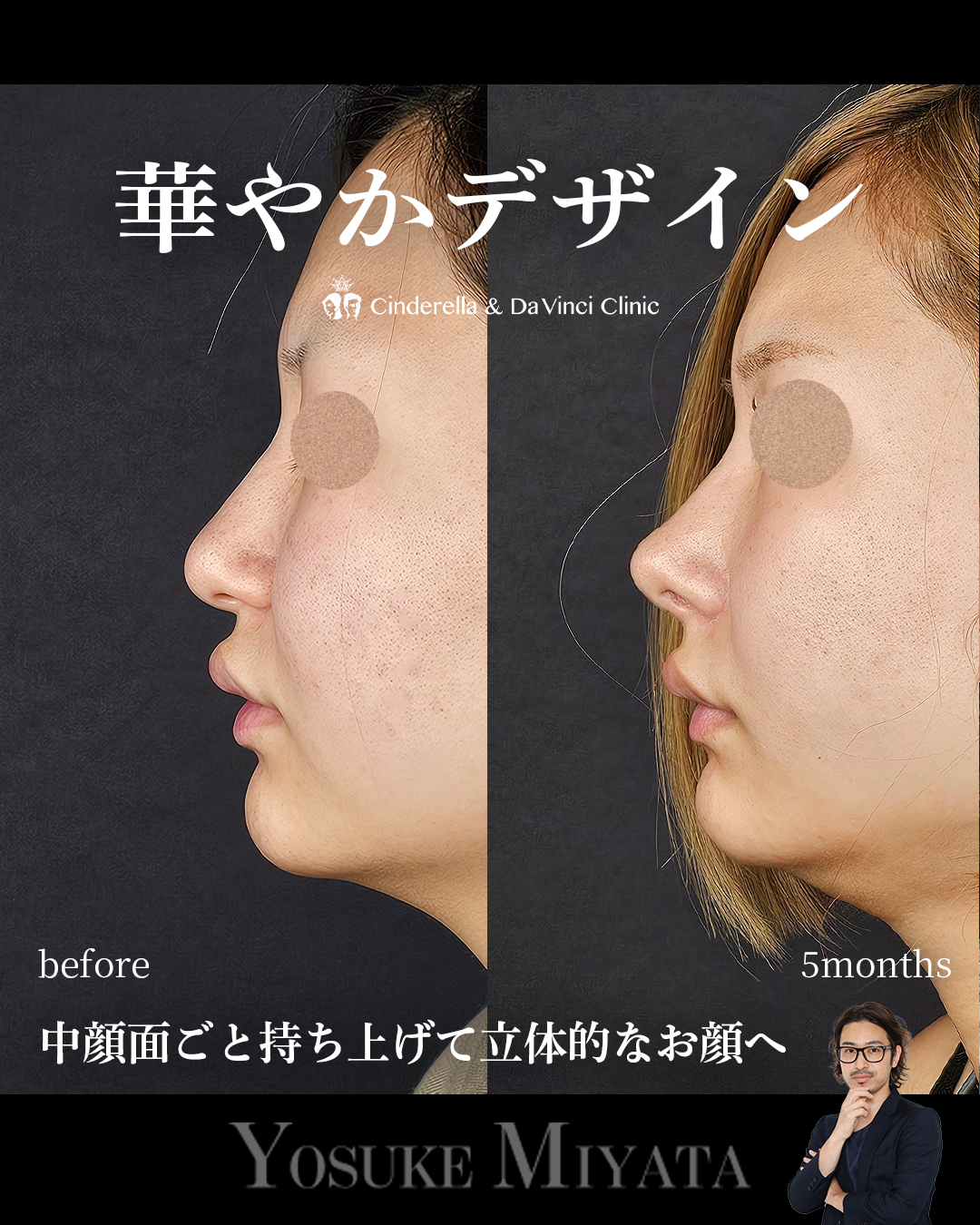 華やか鼻の画像