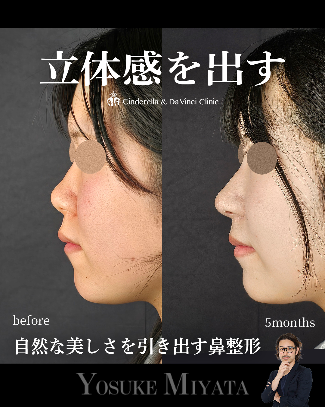 お顔に立体感を出すの画像