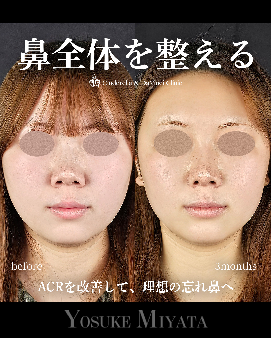 鼻全体を整える