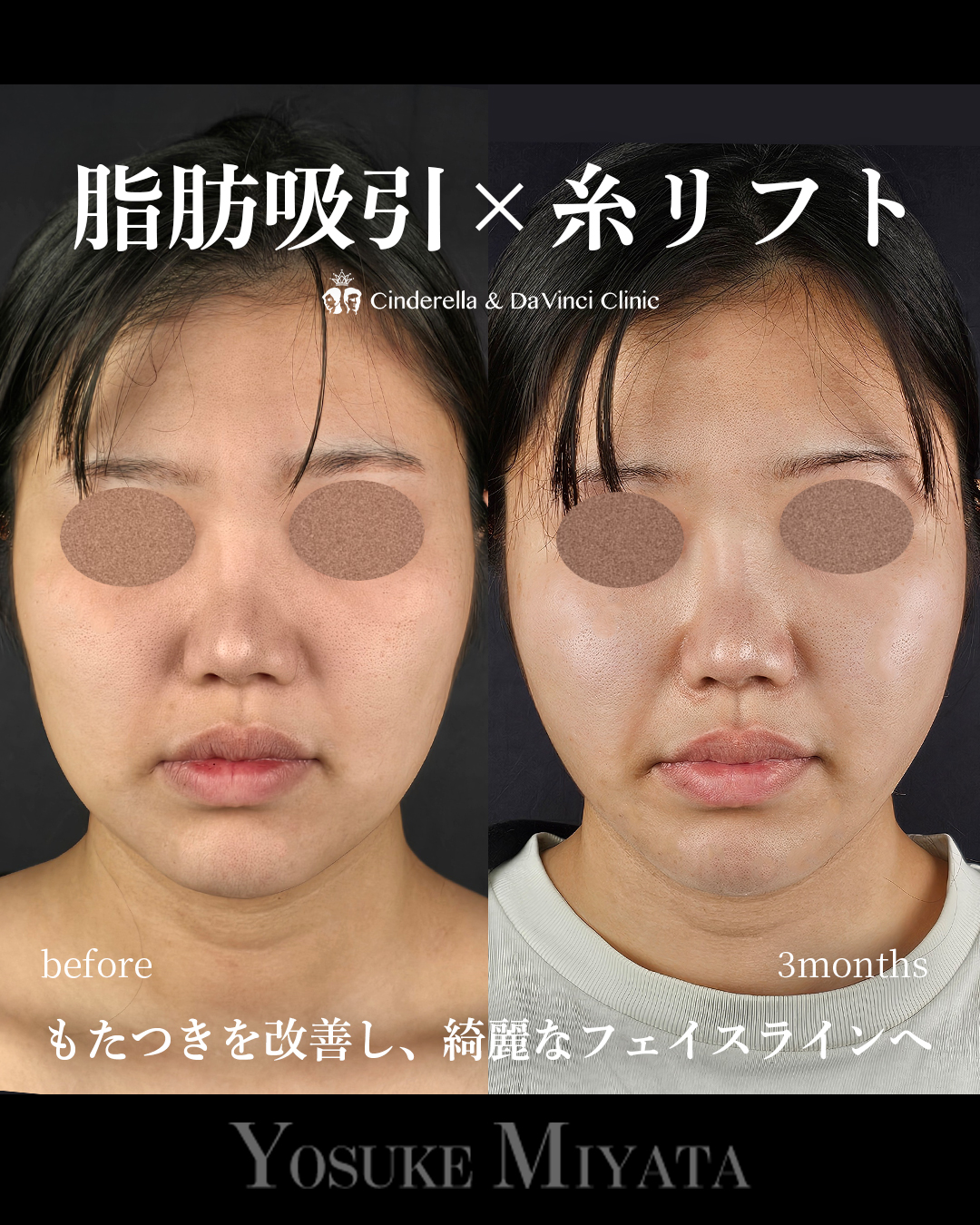 綺麗なフェイスライン