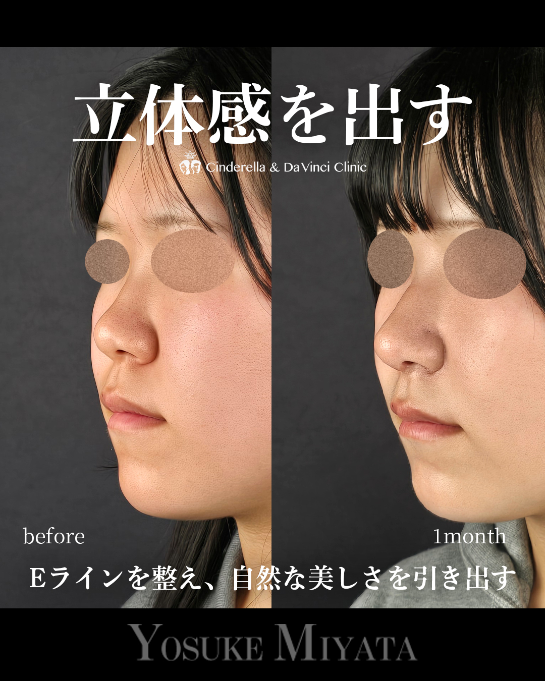 お顔に立体感を出すの画像