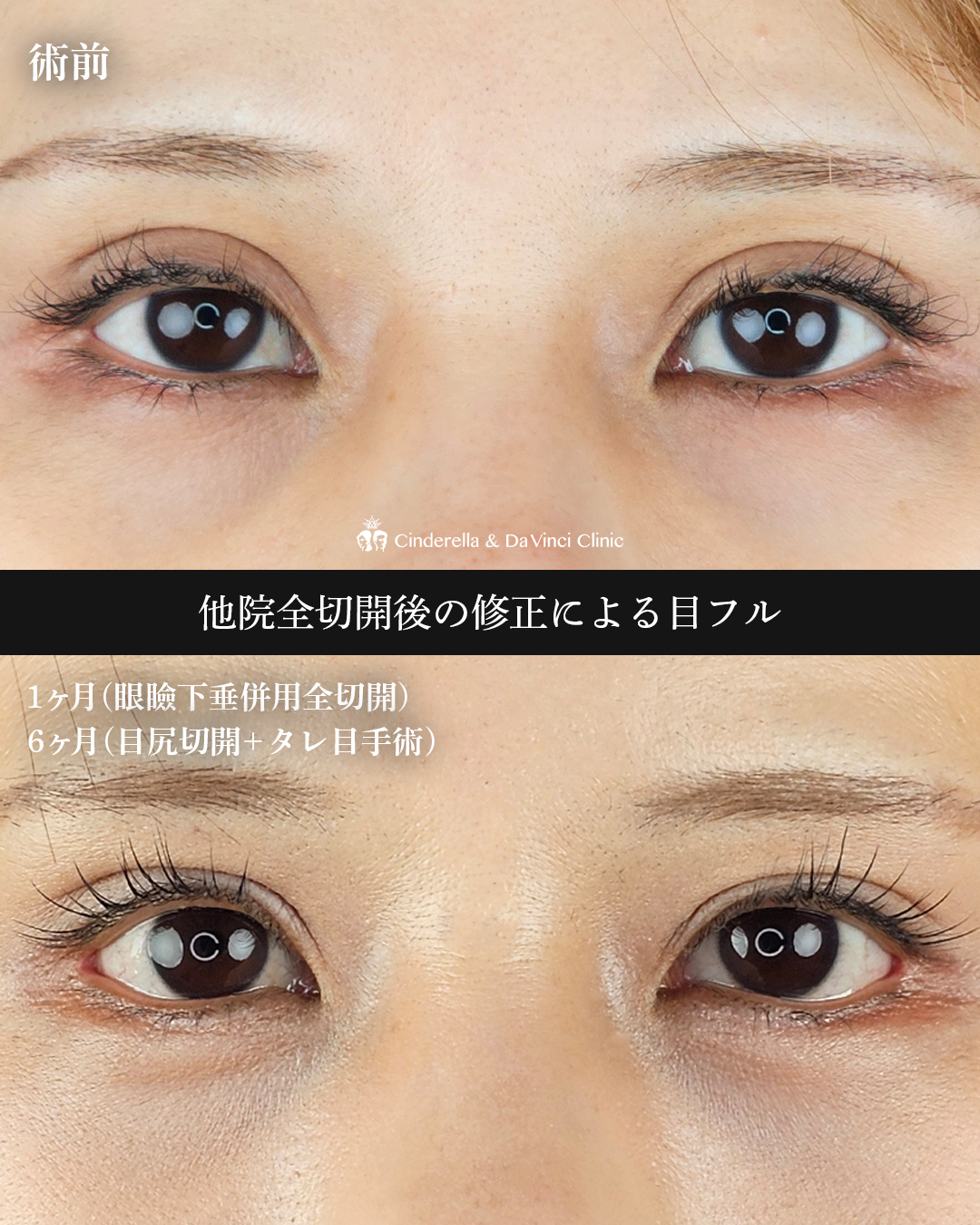 三施術併用の画像