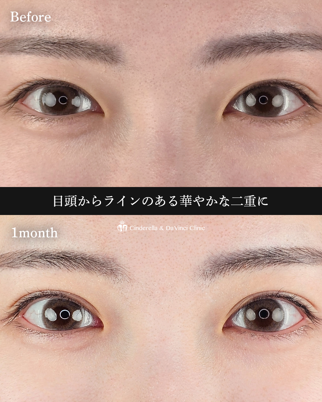 華やか二重の画像