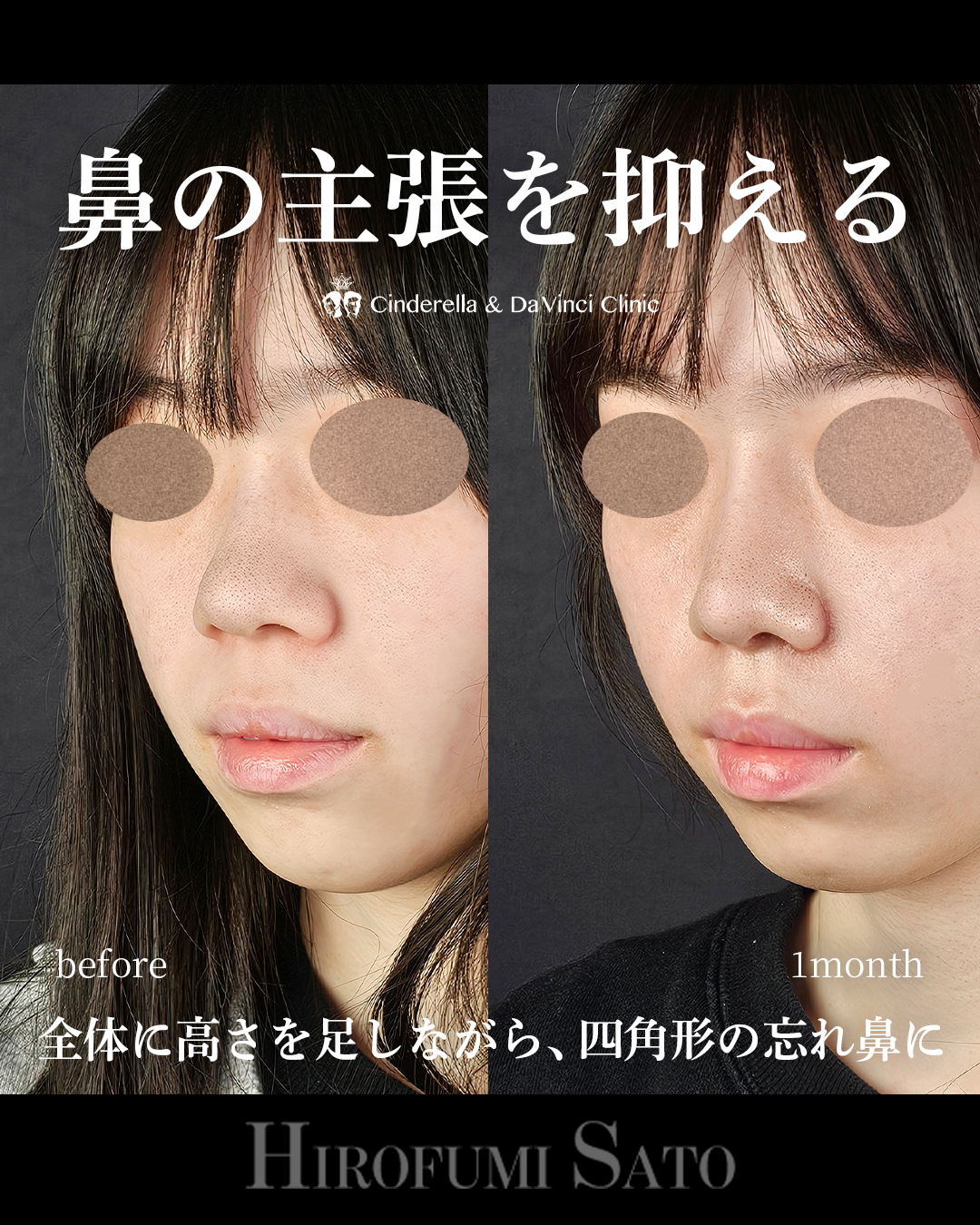 鼻の主張を抑えるの画像