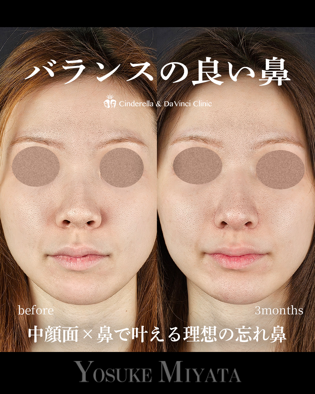 バランスの良い鼻の画像