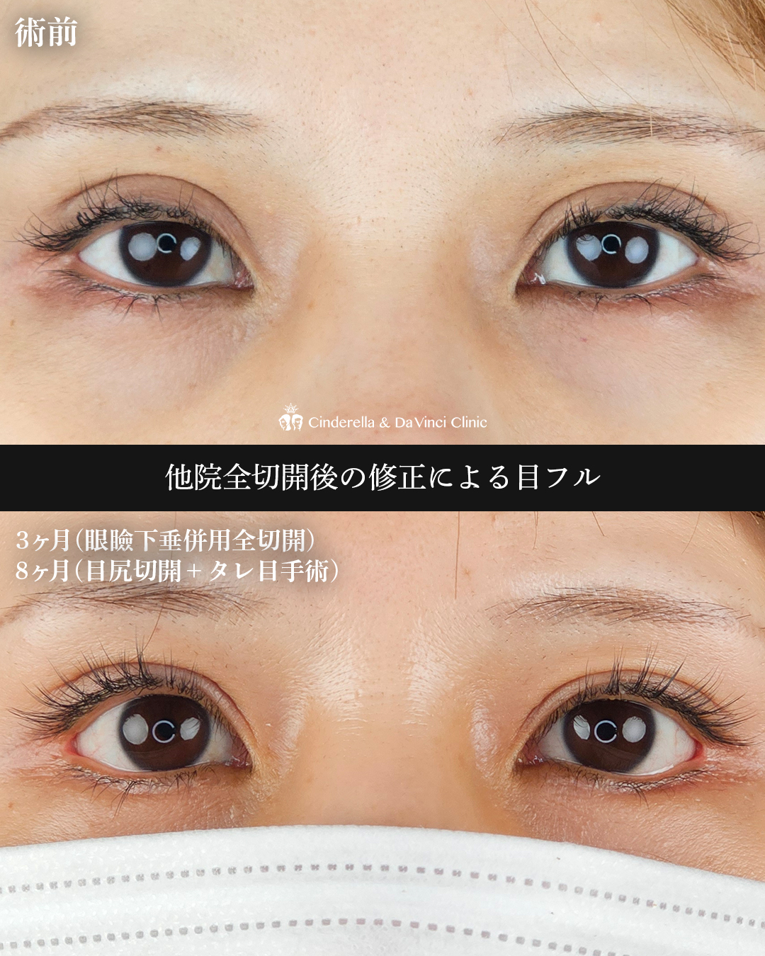 三施術併用の画像