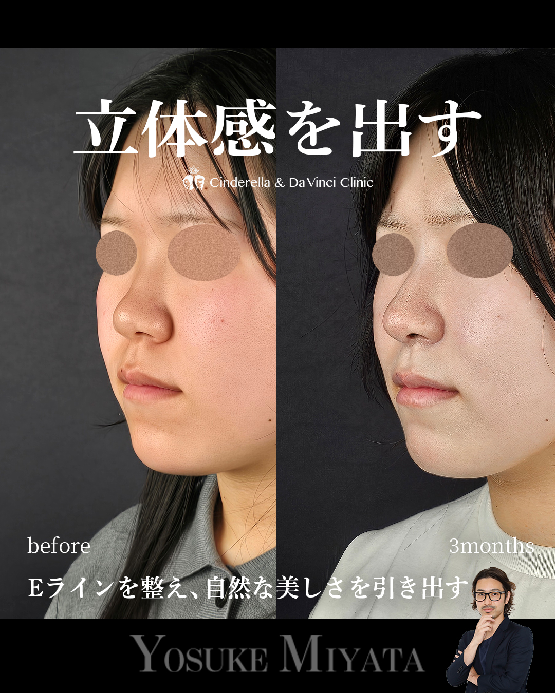 お顔に立体感を出すの画像