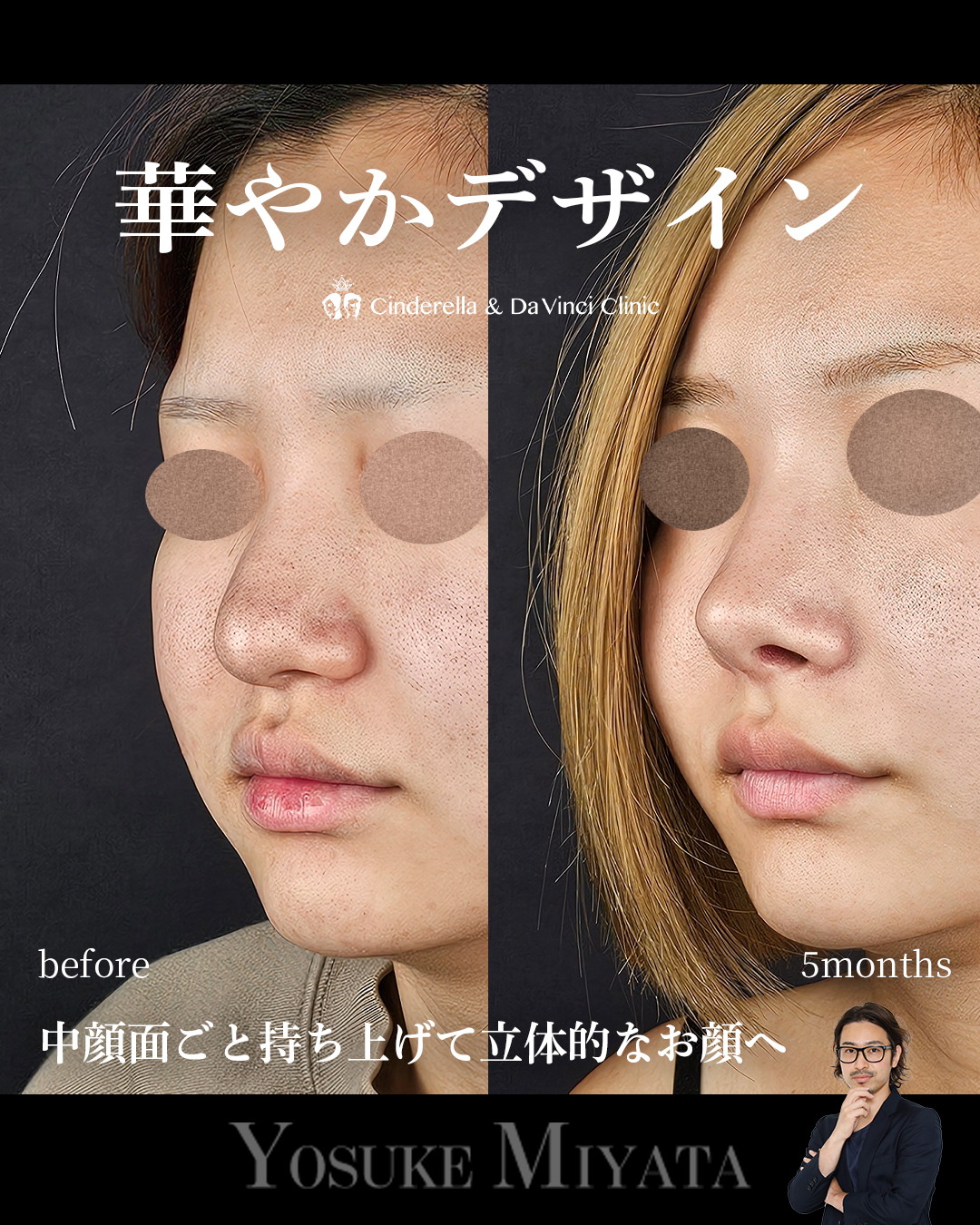 華やか鼻の画像