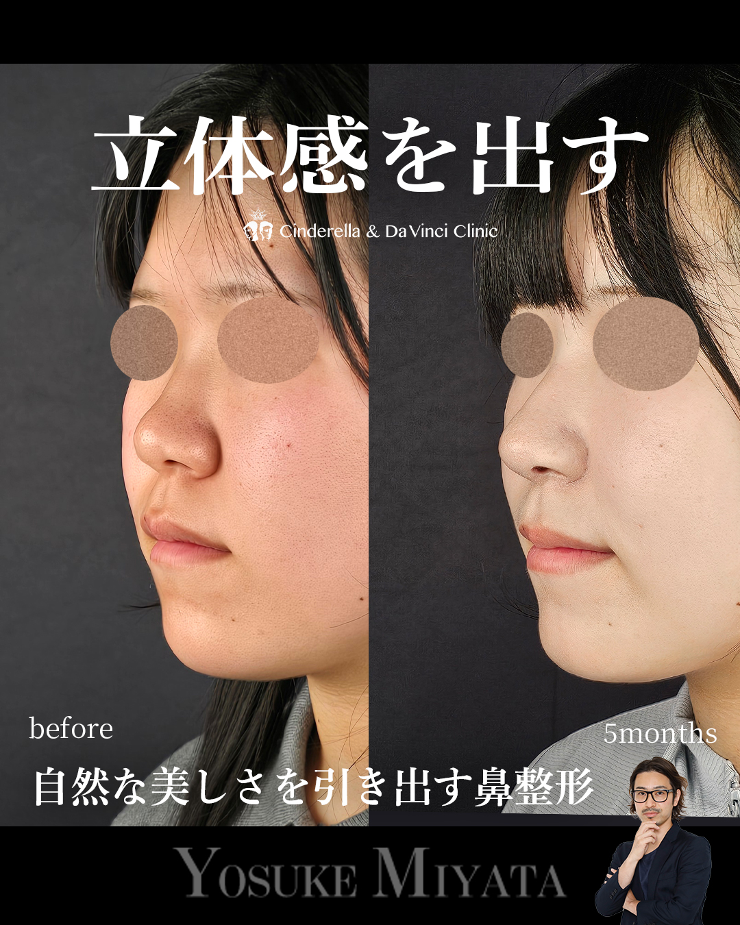 お顔に立体感を出すの画像