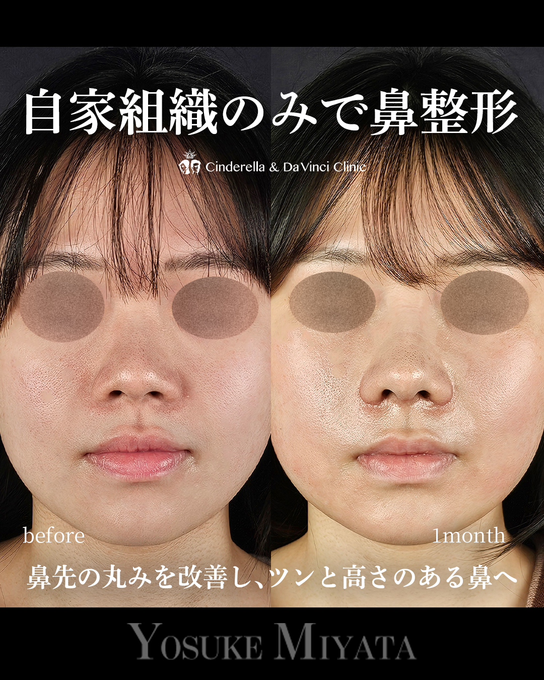 すべて自家組織の画像