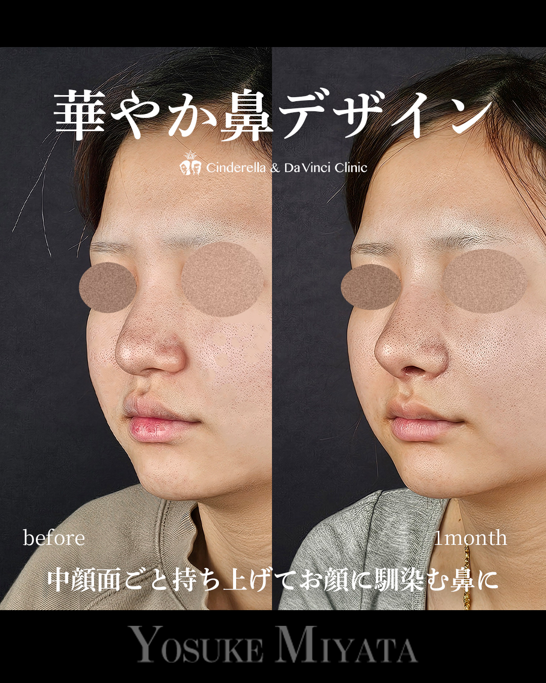 華やか鼻の画像