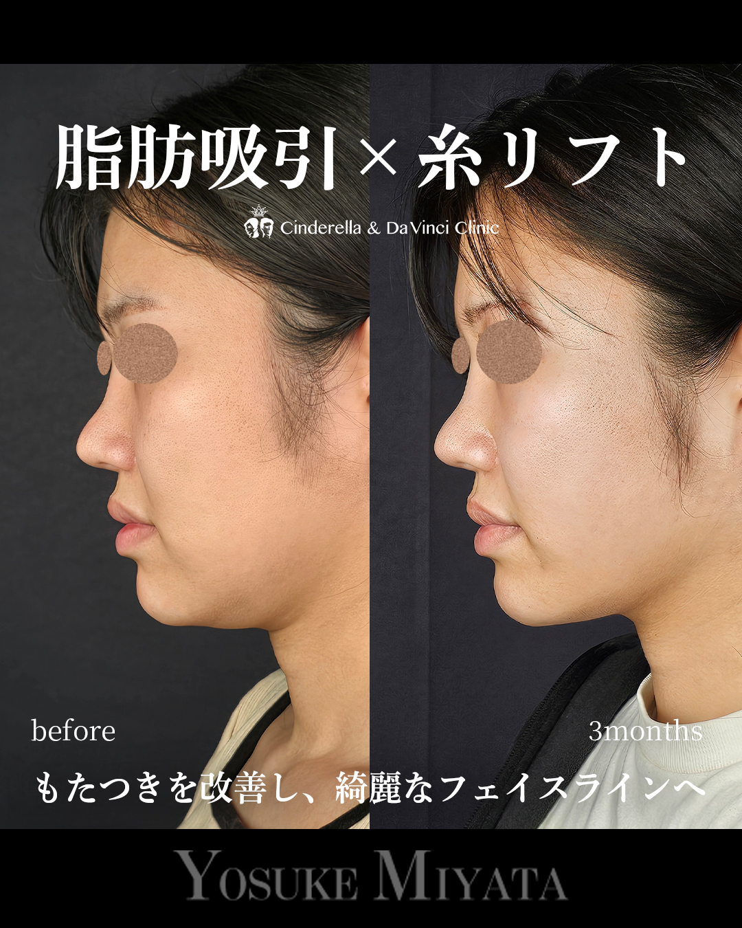 綺麗なフェイスラインの画像