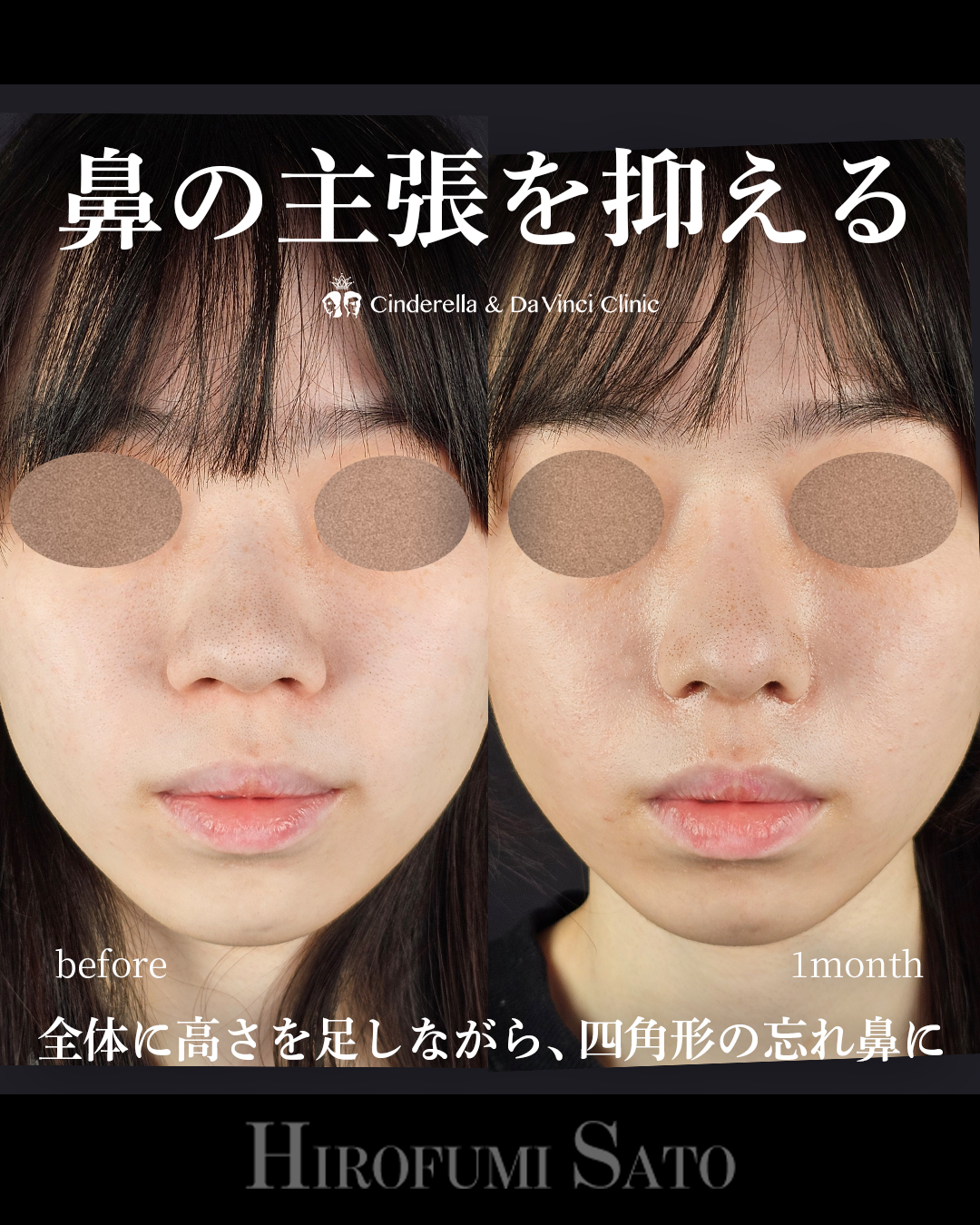 鼻の主張を抑えるの画像