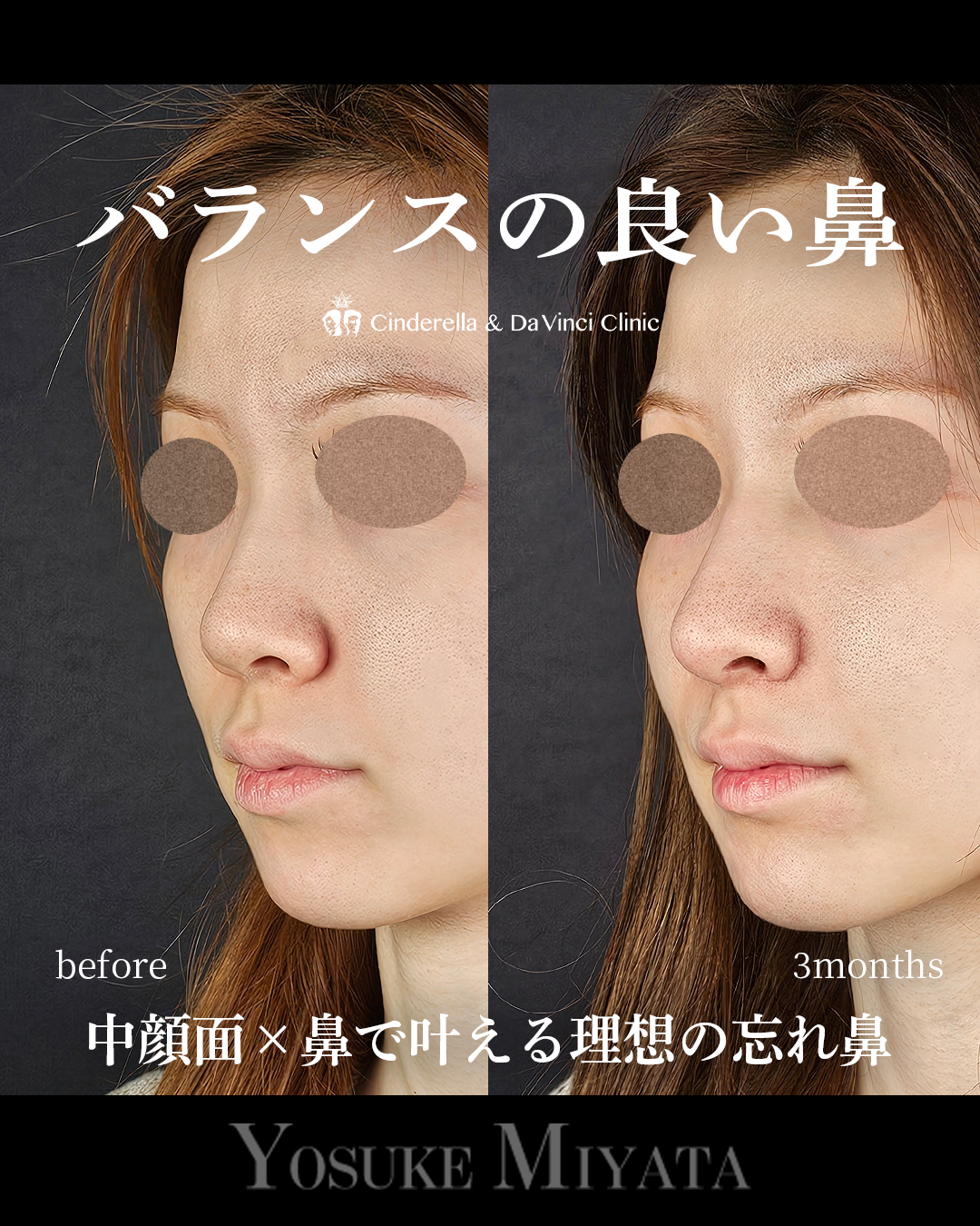 バランスの良い鼻の画像