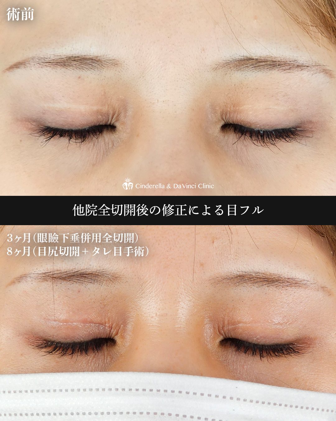 三施術併用の画像
