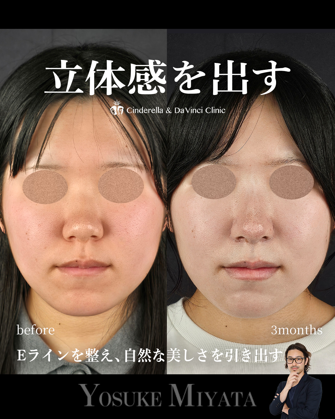 お顔に立体感を出すの画像