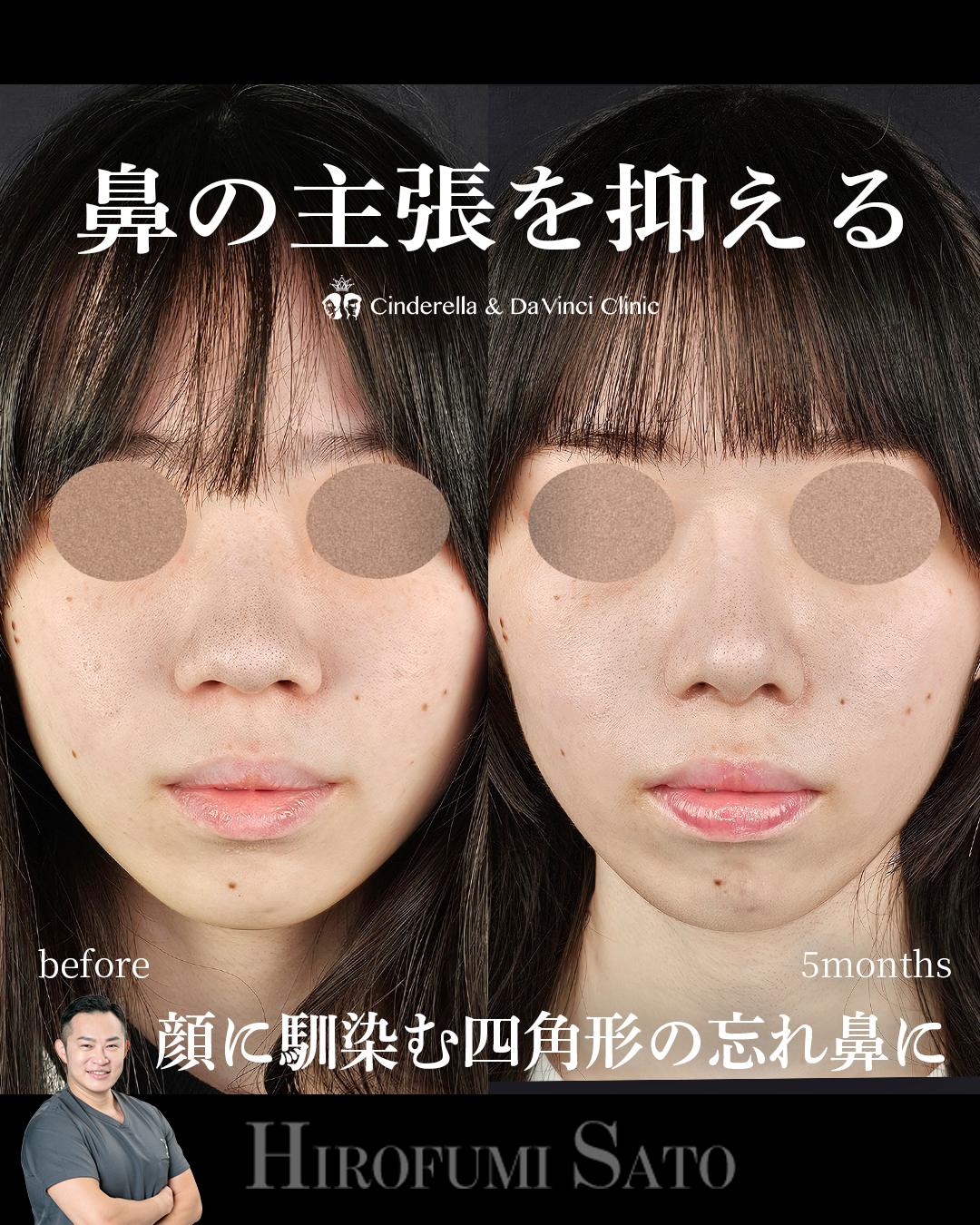 鼻の主張を抑えるの画像
