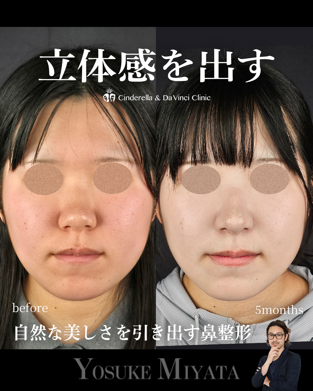 お顔に立体感を出すの画像
