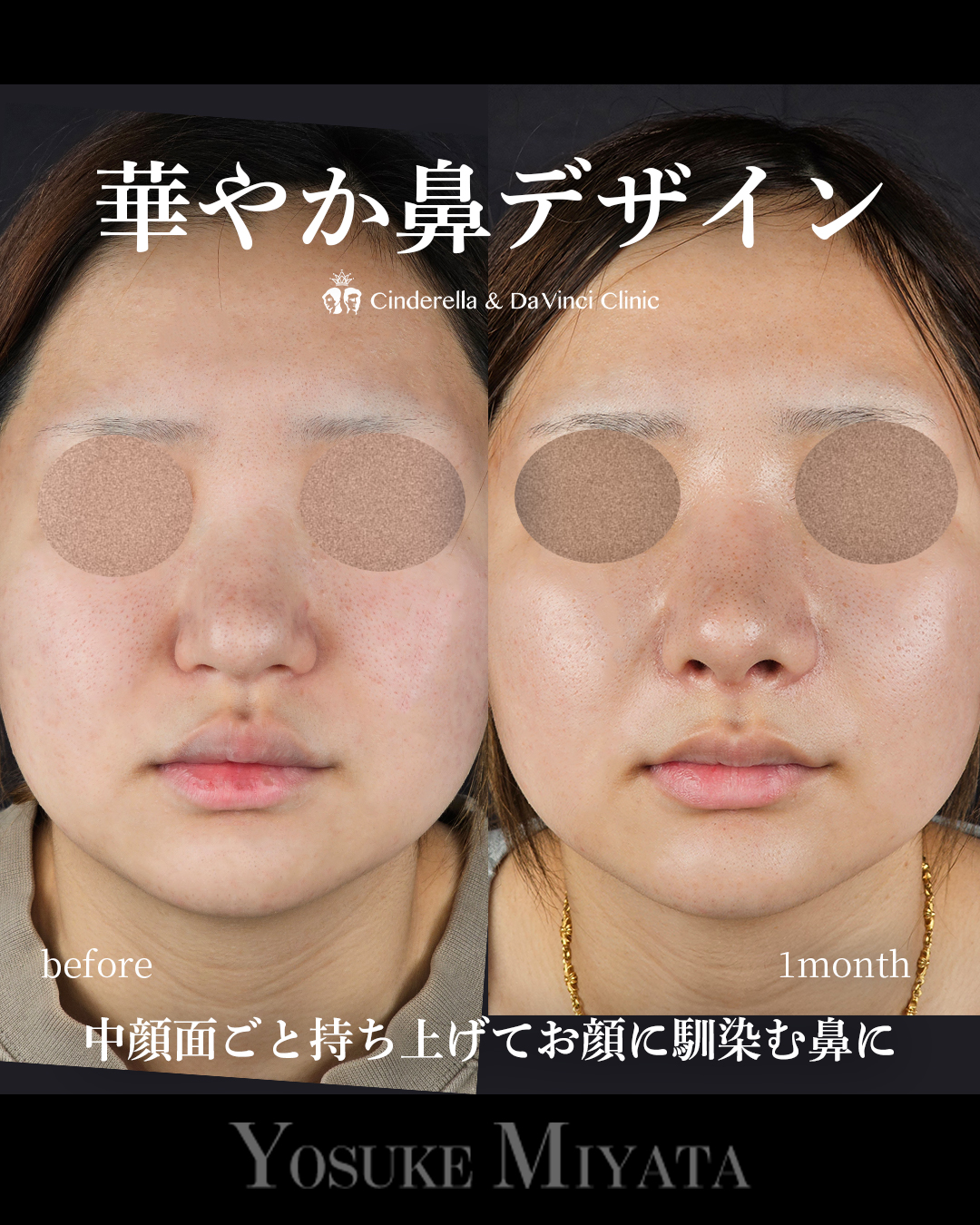 華やか鼻の画像