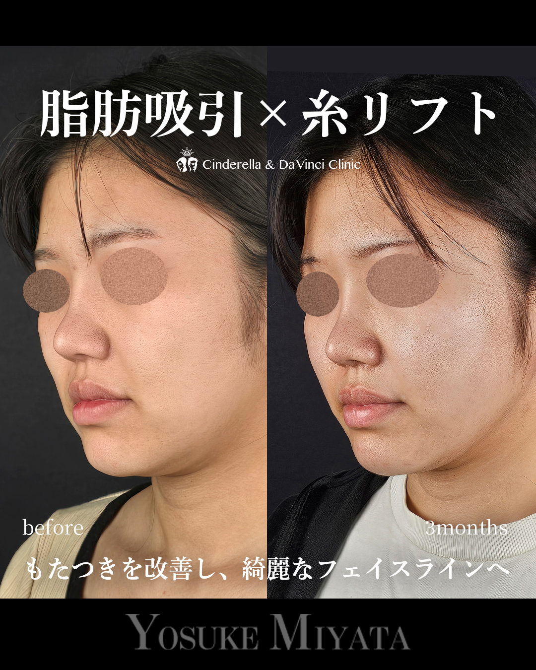 綺麗なフェイスラインの画像
