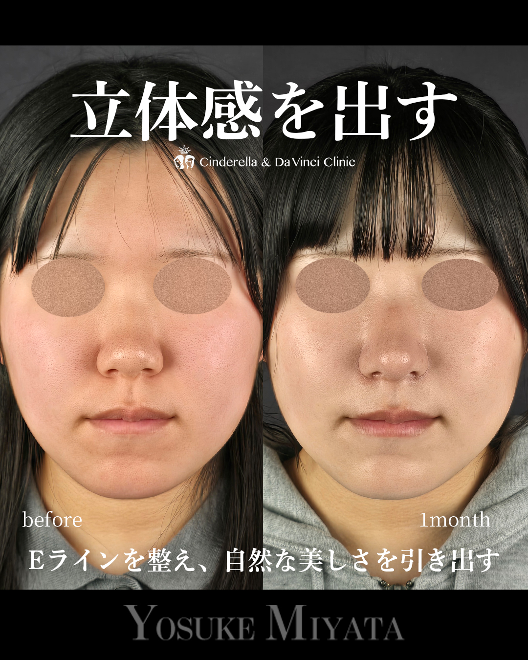お顔に立体感を出すの画像