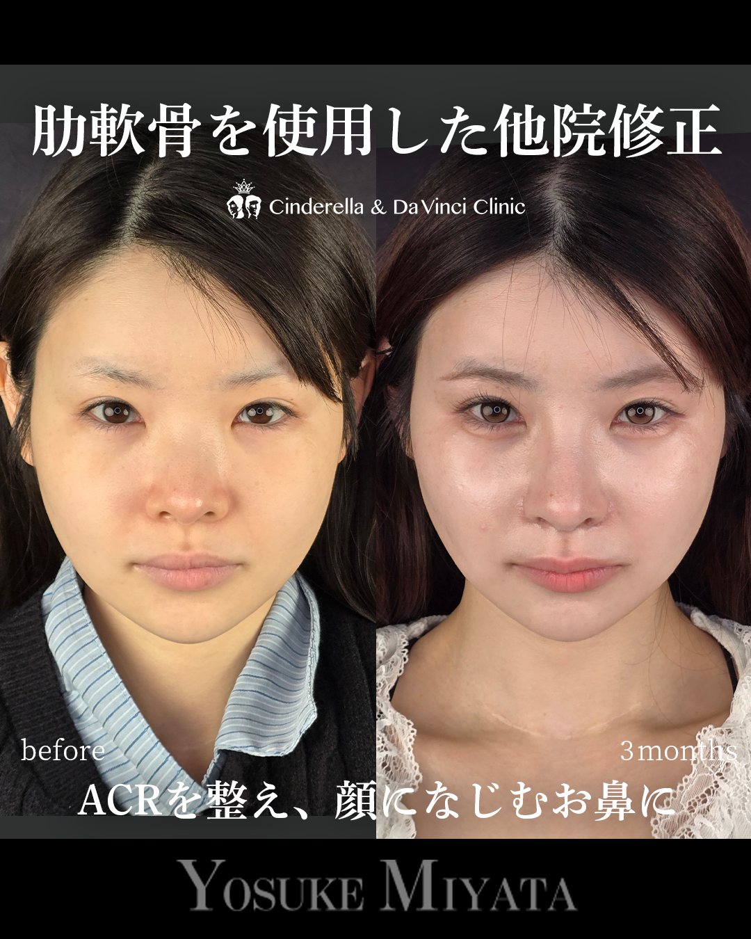 忘れ鼻をつくるの画像