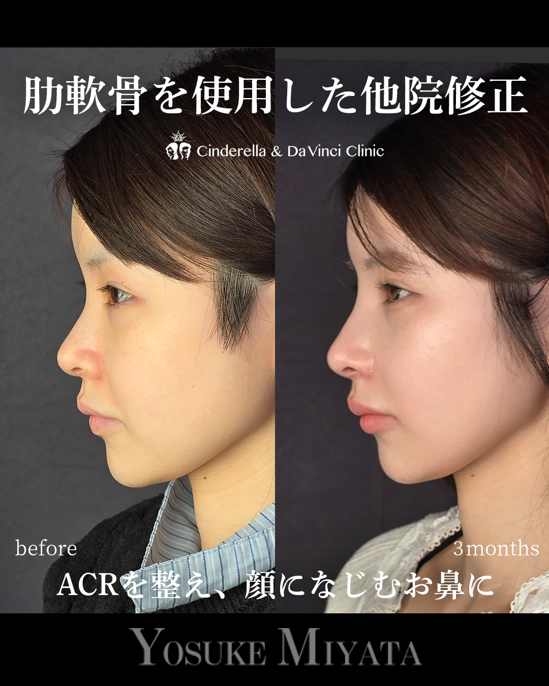 忘れ鼻をつくるの画像