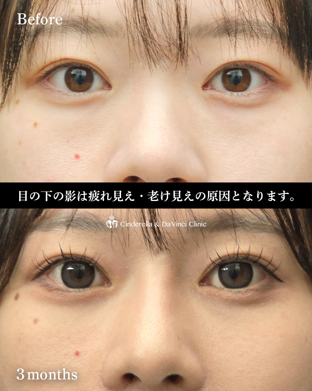 クマ治療の画像