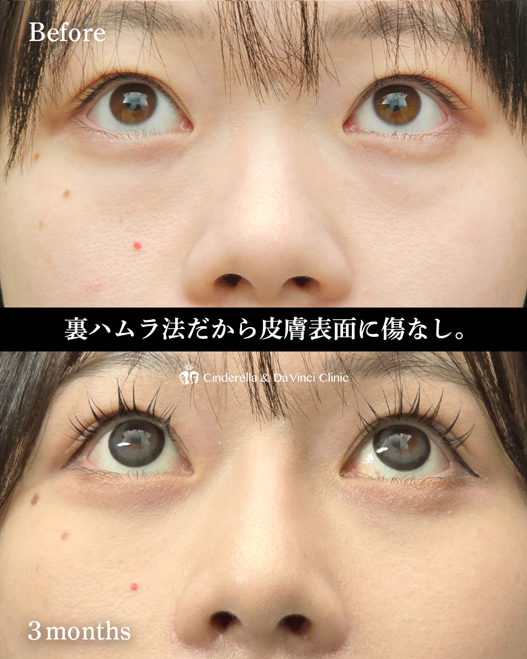 クマ治療の画像