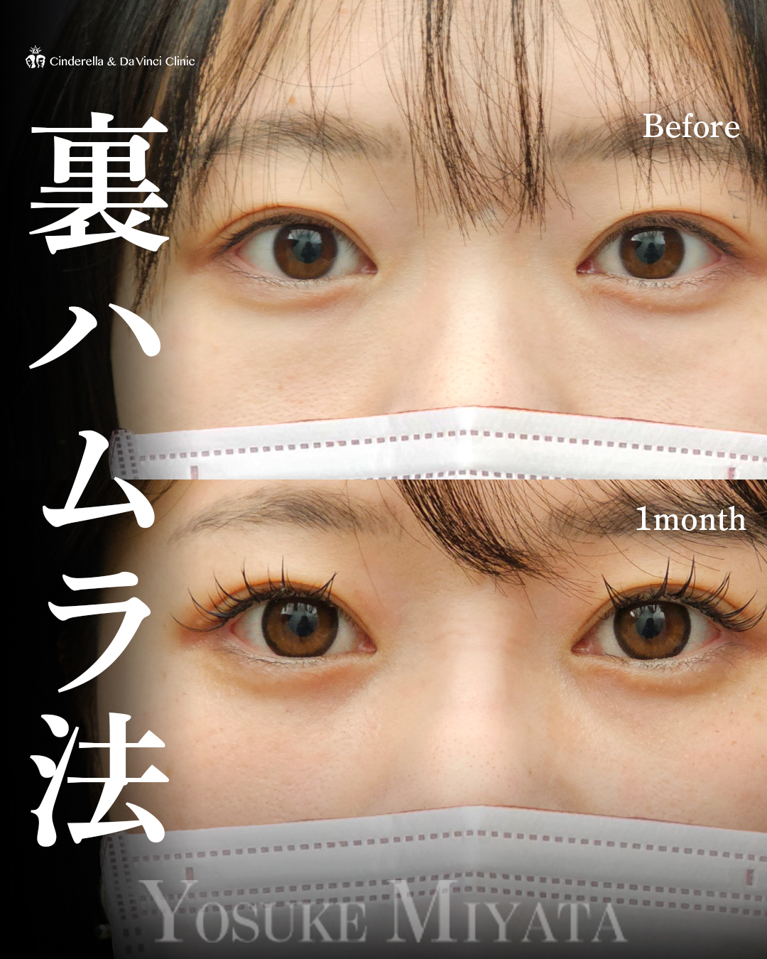 クマ治療