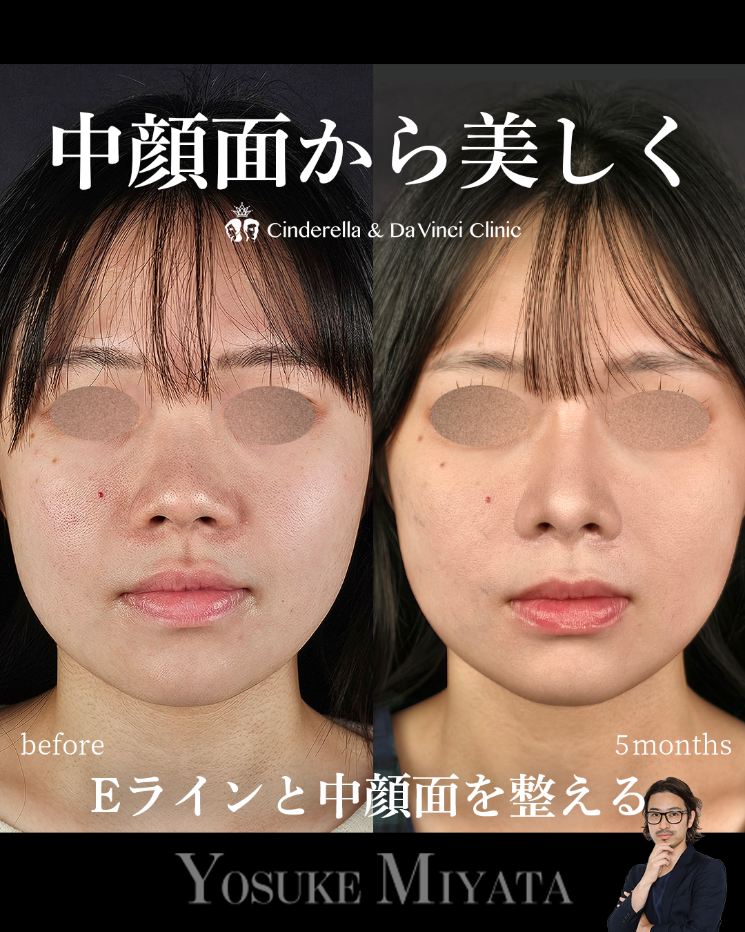 すべて自家組織の画像