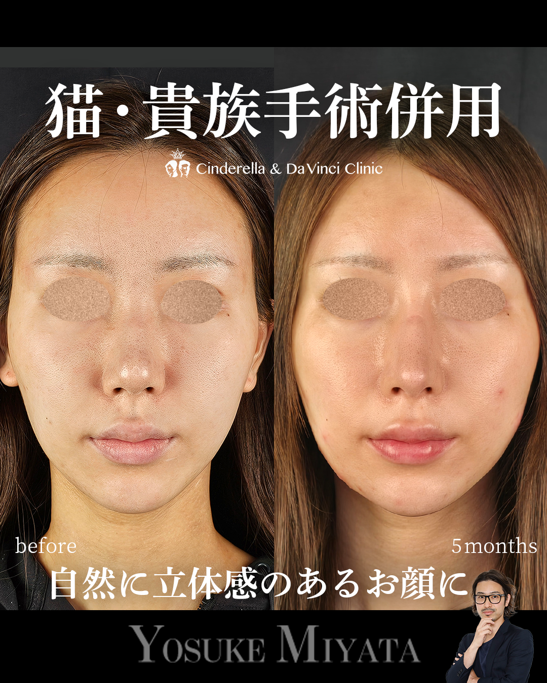 猫・貴族手術の併用の画像