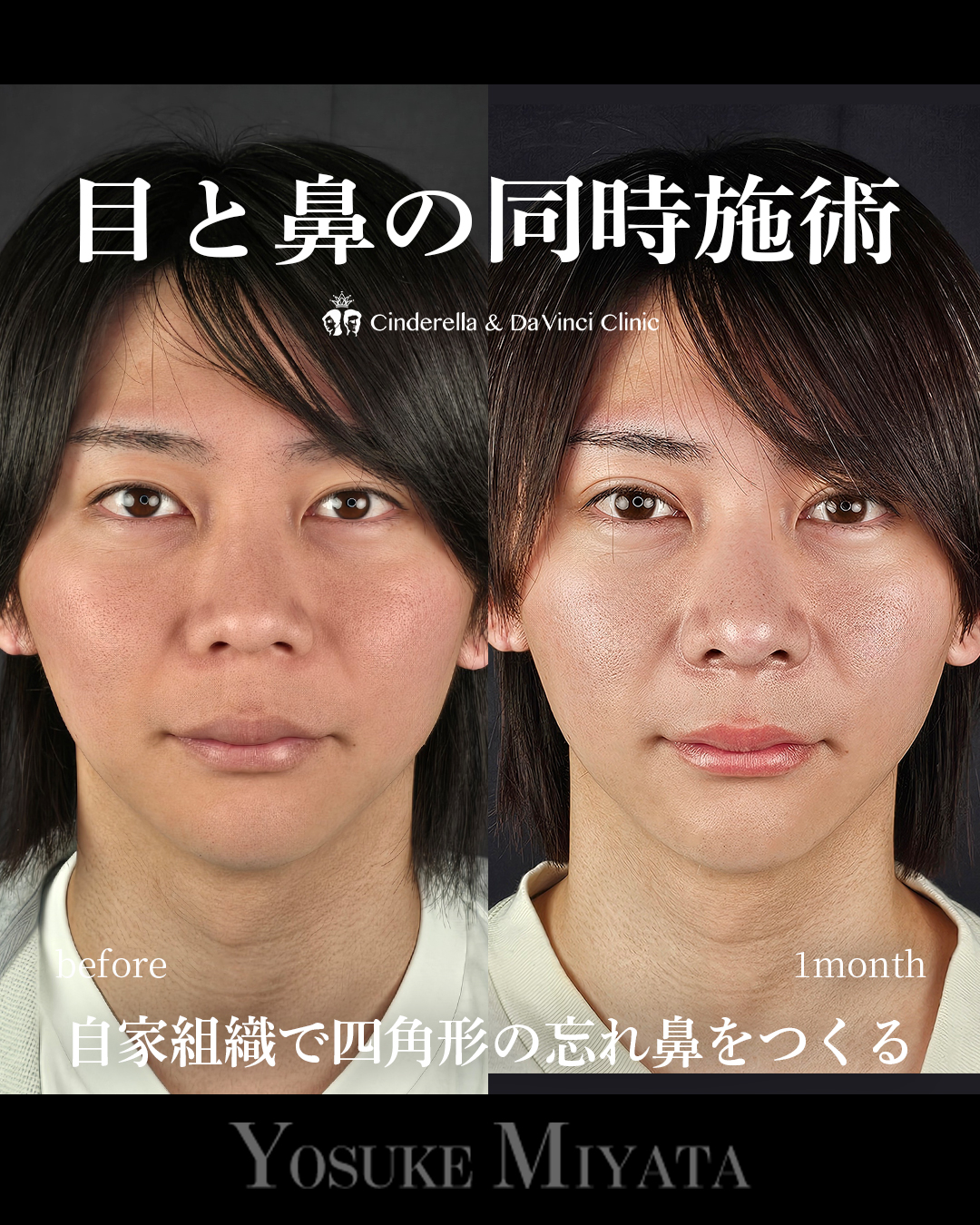目と鼻同時