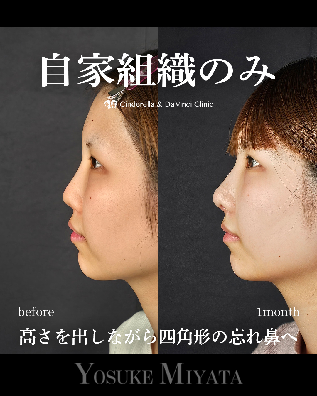 自家組織のみ